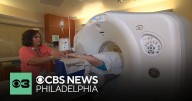 What to know about lobular breast cancer, which is on the rise in the United States
