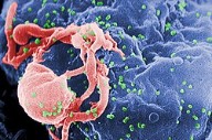 Avances médicos acercan la cura del VIH: nuevos tratamientos, vacunas y terapias genéticas