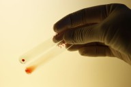 Health Rounds: Scientists change kidney blood type, a potential advance for transplant recipients