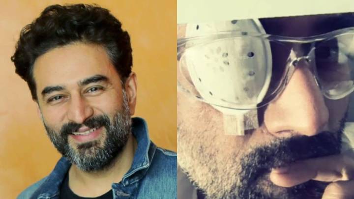 Shekhar Ravjiani Reveals He Underwent Cataract Surgery, Says Vision Was 'Perpetually Hazy' For 4 Years