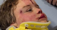 Mother urges stricter e-bike laws after crash injures son