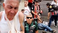 Habló el jubilado al que la Policía de Patricia Bullrich le quebró un brazo: "Me tiraron como un misil"
