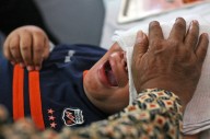 Además de Tylenol, ahora EE. UU. promueve nexo infundado entre circuncisión y autismo