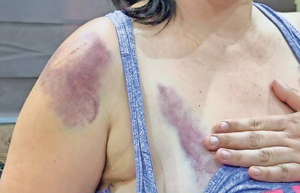 Fácil, acceder a redes que incitan agresiones