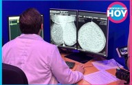 Quintana Roo: primer estado de Latinoamérica en usar IA para detectar cáncer de mama