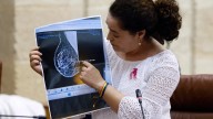 La Fiscalía de Sevilla investiga si se modificaron historiales médicos del programa de detección de cáncer de mama