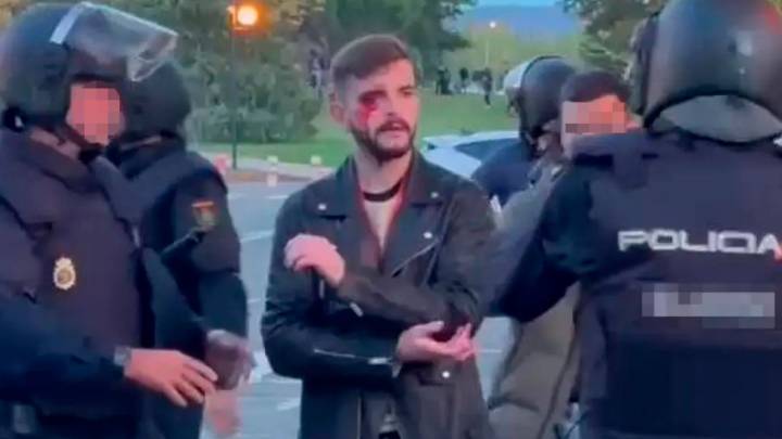 El periodista atacado por la manada de 'abertzales': "Si me hubieran atrapado en el suelo mis heridas serían muy graves"