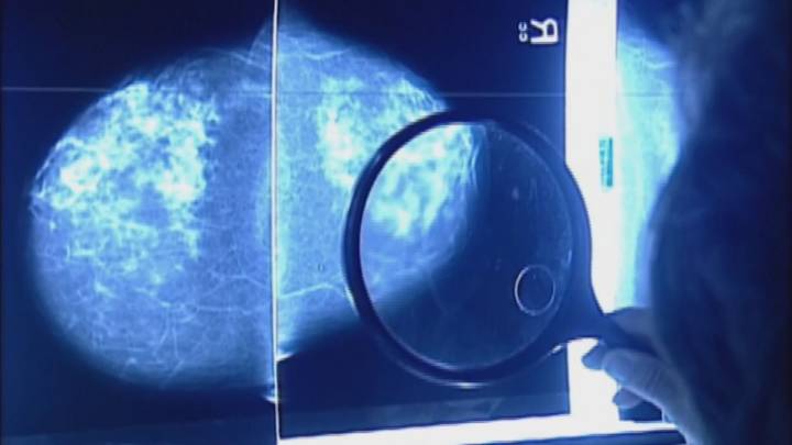 Lifestyle changes that can lower breast cancer risk