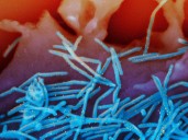 As winter virus season nears, Kaiser Permanente begins RSV vaccinations for pregnant moms