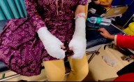 Father of Delhi ‘acid attack victim’ arrested for fabricating assault story