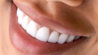 The best time to whiten your teeth