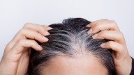 El misterio de las canas prematuras y el por qué aparecen en personas jóvenes y qué dice la ciencia sobre revertirlas