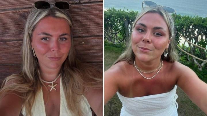 24-Year-Old UK Woman Dies Days After Doctors Diagnosed Her Rashes As Allergies
