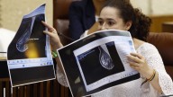 Andalucía eleva a 2.317 mujeres las afectadas por los fallos en el cribado del cáncer