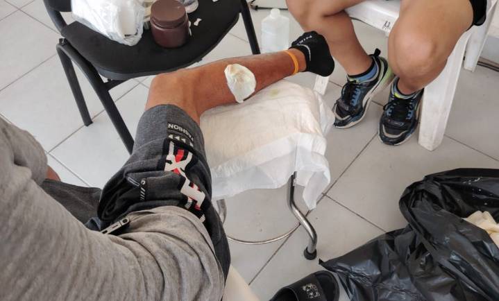 Migrante cubano infectado con miasis solicita ayuda a Sheinbaum
