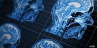 Hillsdale Hospital partners with radiology group to provide faster test results