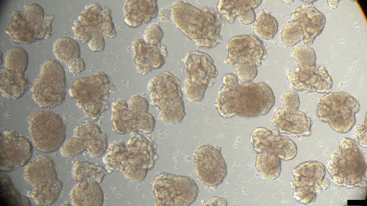 Los organoides de riñón producidos en serie abren la vía a mejorar los trasplantes