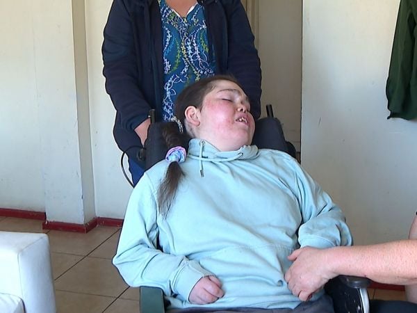 Madre pide apoyo para hija con enfermedad rara