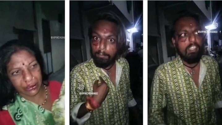 MP News: Over 20 Drunk Men Break Into House, Attack Family Over Dispute With Neighbour In Shajapur-