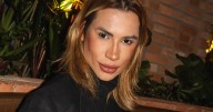 Influencer dies after complications from 'fox eyes' cosmetic surgery