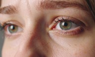 Nearly 1 bn people in low-and middle-income countries living with avoidable vision loss: Report