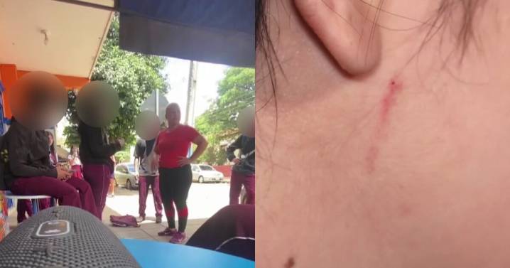 "Se fueron juntos contra mí": Madre e hijo protagonizan agresión contra estudiante en Paraguay (VIDEO)