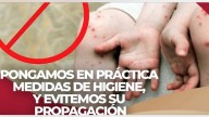 Descarta Salud estatal la alerta epidemiológica