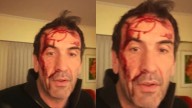 Golpearon a un candidato de La Libertad Avanza: "Zona liberada"