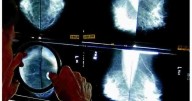 Detect breast cancer early with mammograms