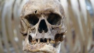 Tooth Grooves On Ancient Human Ancestors May Not Be Evidence Of "Oldest Human Habit" After All
