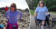 Mum tells of horror after she woke from coma to find leg amputated following head