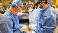 Canada’s first non-beating heart transplant could lead to shorter wait lists: UHN