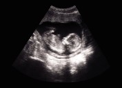 Miraculous ‘Hand of God’ figure turns up in mother’s ultrasound after praying for baby’s health