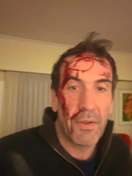 Violenta entradera en la casa del diputado Pablo Cervi: lo golpearon y le gatillaron dos veces