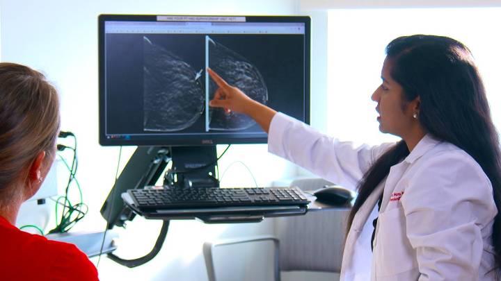 Researchers develop AI to help detect hard-to-spot lobular breast cancer