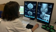 Madrid participa en un ensayo de un fármaco contra el cáncer de mama