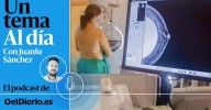 🎙 PODCAST | Mamografías: el síntoma de un sistema público enfermo