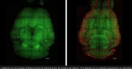 Científicos logran revertir el alzhéimer en ratones mediante nanopartículas