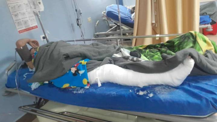 EPS niega cirugía vital a joven accidentada que lucha por volver a caminar