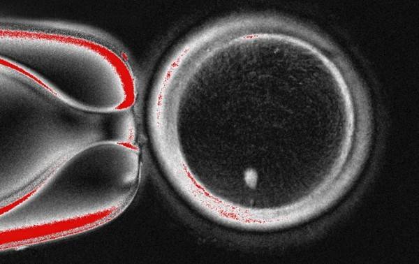 Investigadores convierten células de piel humana en óvulos