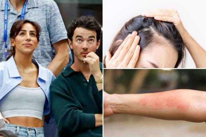 Danielle Jonas diagnosed with Lyme disease after experiencing 'traumatic' symptom