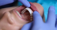 Gum Disease May Raise Stroke Risk, Even Damage the Brain