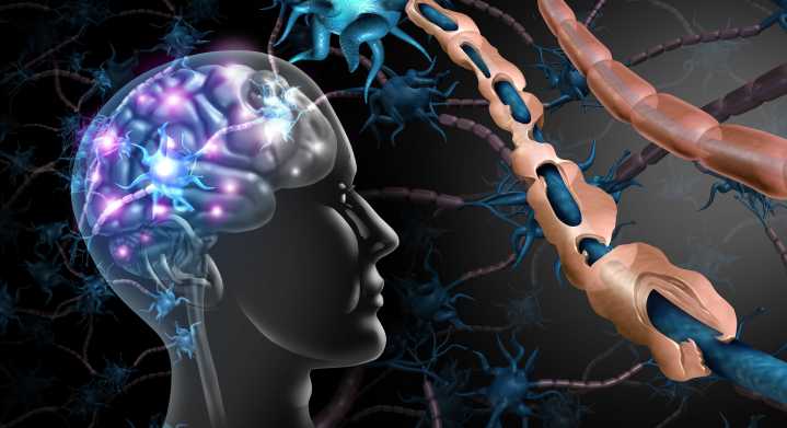 A Conversation with Francesca Bridge, MBBS, Neurologist at Alfred Health in Melbourne, Australia and Ph.D. Candidate at Monash University