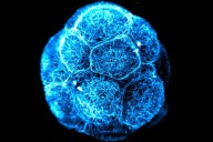 Stem cells sound magical, but they’re not all created equal. Here’s what you need to know