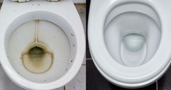 Ni vinagre ni bicarbonato: la mezcla casera perfecta que elimina el sarro y las manchas del inodoro en segundos