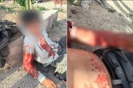 Dos pitbull atacaron a un hombre de 75 años y le provocaron graves heridas