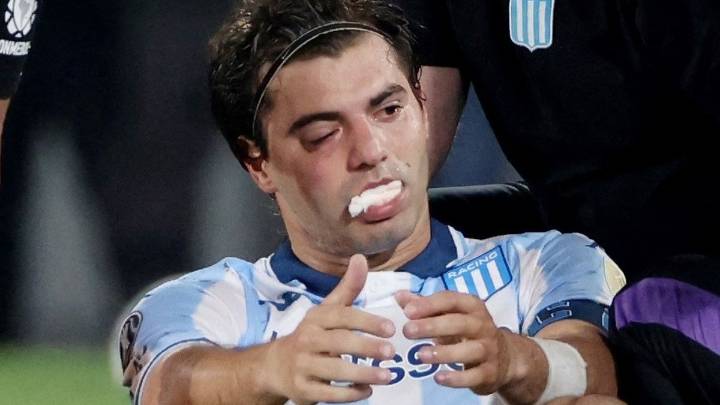 Santiago Sosa sufrió una fractura tras el golpe con Marcos Rojo en Flamengo vs. Racing