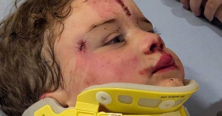 Mother urges stricter e-bike laws after crash injures son