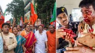 BJP MP Murmu, still in ICU, may require surgery; no arrest yet in connection with attack