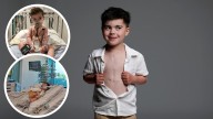 Telethon 2025: Meet Hemi Andrews, the boy with half a heart who lives with twice the courage